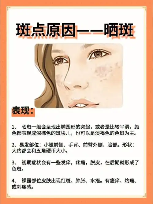 各种斑点形成原因之晒斑的形成原因