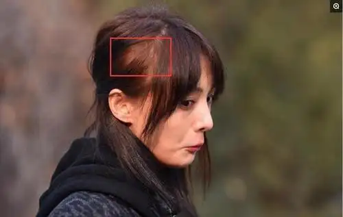 半个娱乐圈的女星都"秃"了,娜扎头发太稀,baby发际线要上天!