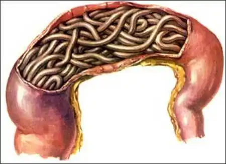 猪消化道寄生虫病及防治