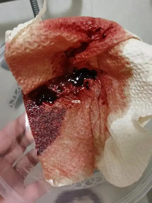 最后一个中秋节,妈妈抠吐了一下午的血