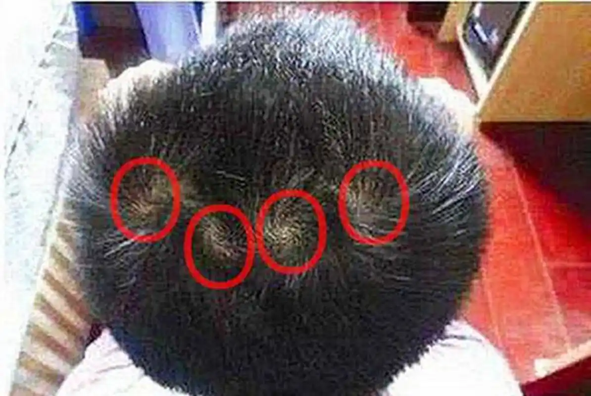 原创头顶两个"旋"的孩子最聪明?看看美国专家的调查,结果意想不到