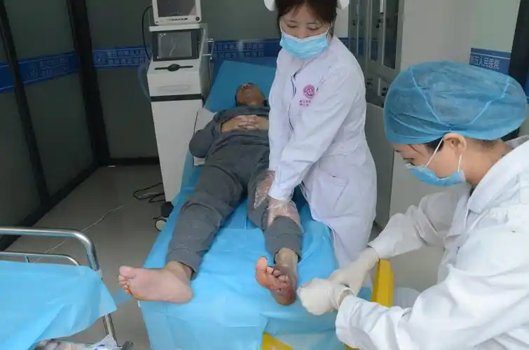 糖尿病人脚烂不愈合这种情况是并发症糖尿病足烂脚的外在表现,糖尿病