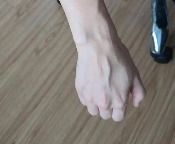 手臂"青筋暴起"的人,与几乎没有青筋的人相比,哪种更健康?