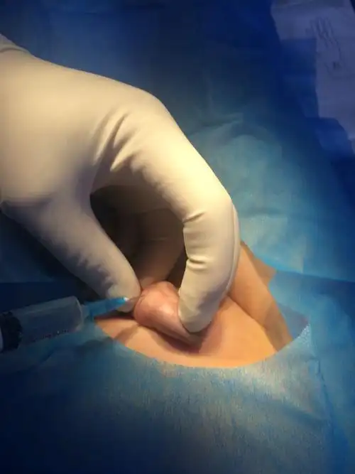 一言不合就把我们总护儿子包皮给割了小伙子走的时候放狠话长大以后要