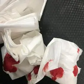 有没有人有带有血的纸巾图急