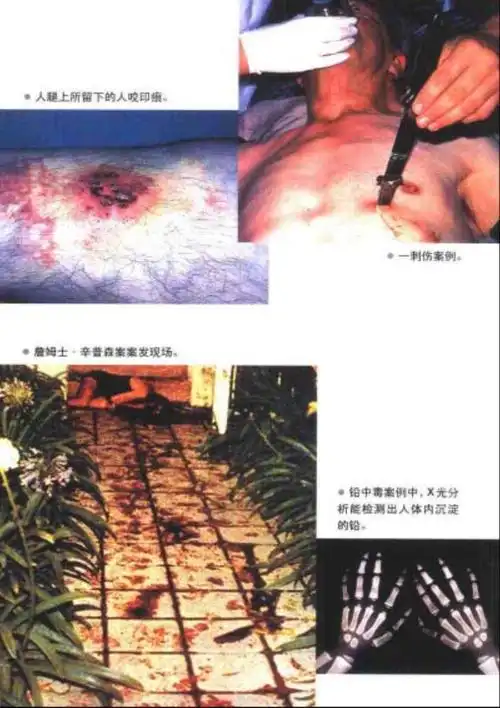 [国际法医探案100例--身体证据.pdf