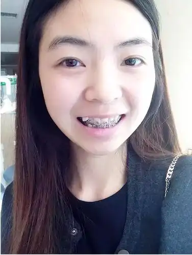 给我一颗虎牙,我能啃坏全世界,包括自己的肉肉!