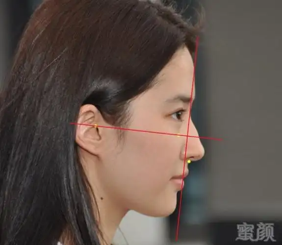 为什么你的侧脸不好看?可能是这4个地方的问题