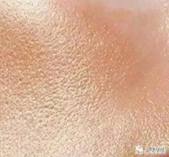 解锁黑头毛孔粗大的秘密