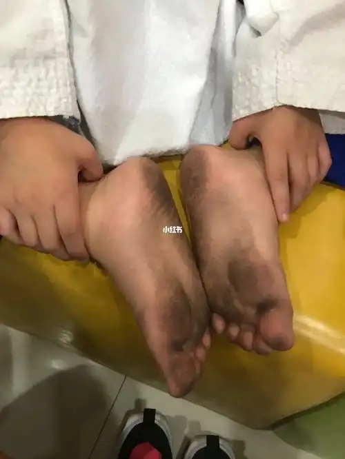 09练完跆拳道的脚呀