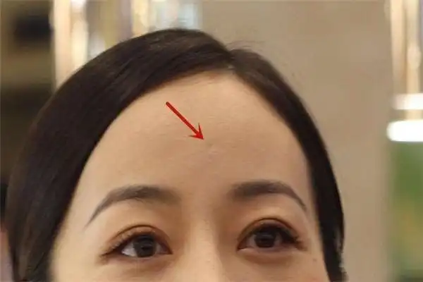 什么叫天庭富贵坑天庭富贵坑不是每个人都有