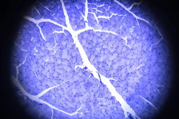 显微镜下骨骼肌横切面图片