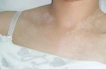 而且每个人身上的发病原因都会有所不同,所使用的治疗方法也会存在