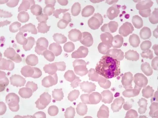 1反映循环池的数量 3.2显微镜法使用低倍镜计数 3.