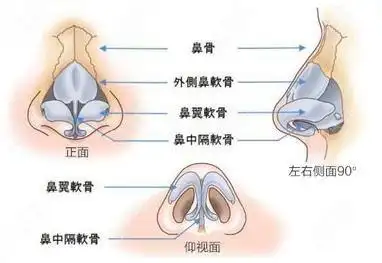 长沙美莱文婷医生隆鼻手术示意图