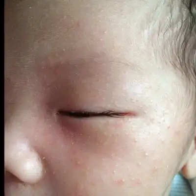 问答 婴儿期0-1岁 宝宝树孕育 90%的妈妈正在使用 宝宝树孕育 90%的