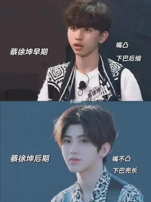 蔡徐坤成名前照片被曝,在韩国双膝下跪太卑微,整容前吓死个人?