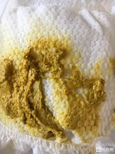 2个月宝宝大便里有虫样线状物