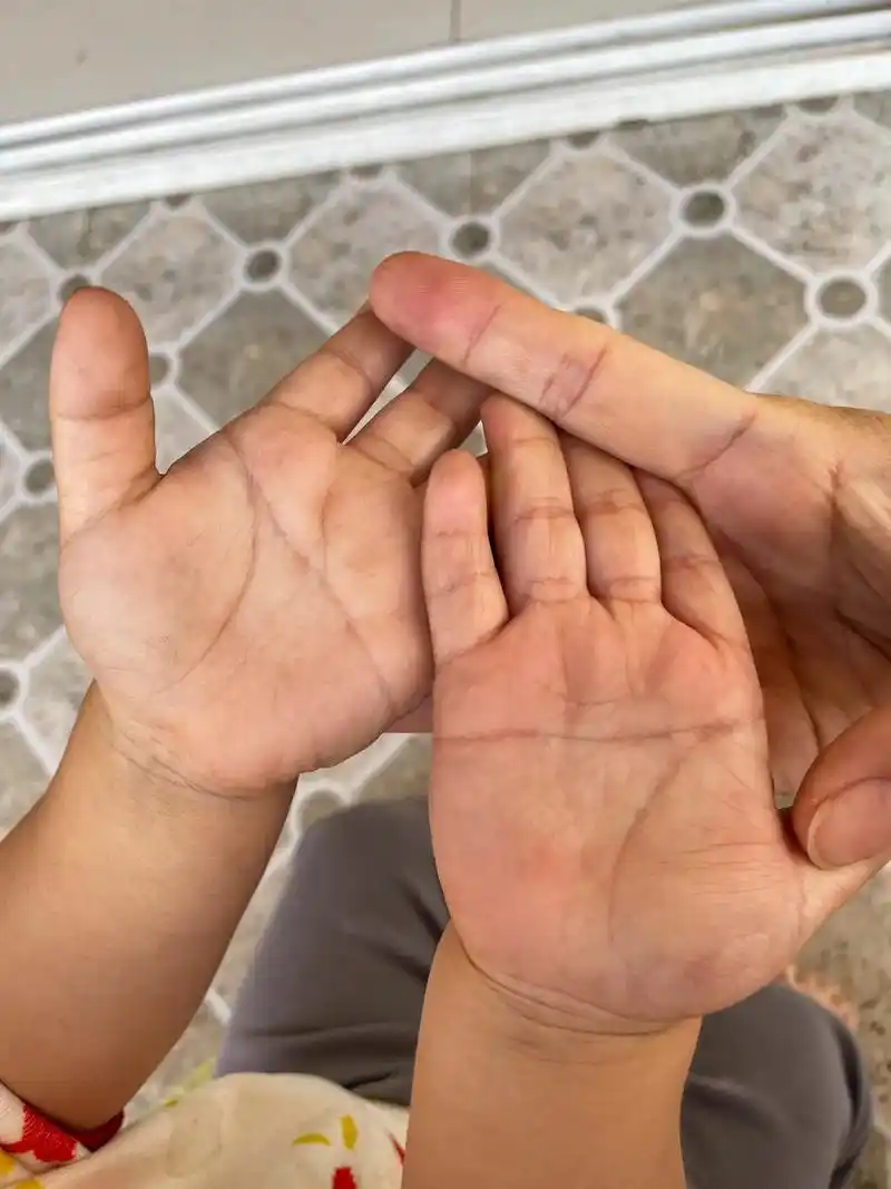 儿保的时候医生提了句宝宝是断掌,你们家有基因吗?我和孩子爸都没有