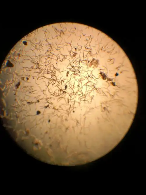 在显微镜下看到的情况,根结线虫密密麻麻.