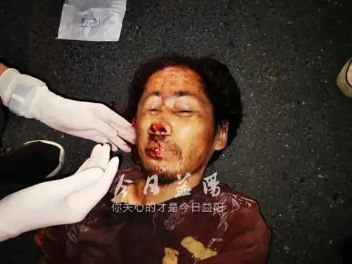 紧急寻找家属!益阳一男子路遇车祸抢救无效死亡