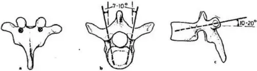 不能要求一定与终板平行,这是和胸椎椎弓根形态有关系