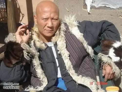 "童年噩梦"计春华 从小无发无眉 天生凶相演反派