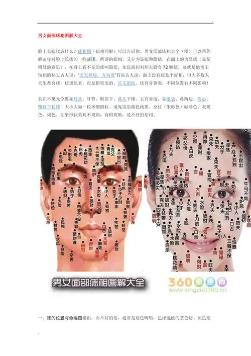 面部痣的位置与命运,男女面部痣相图解大全