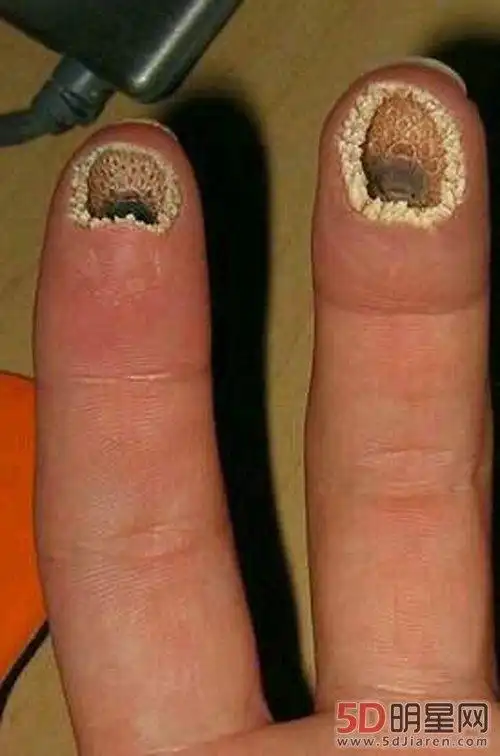 空手指图片_蓬莱和空手指图片_空手指 莲蓬图片