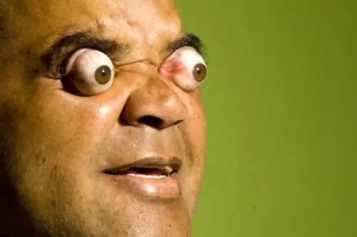 人体器官潜能 眼睛喷射牛奶2.8米