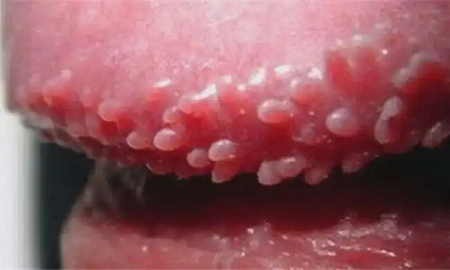 人前勿点男士都好奇的女性生理知识