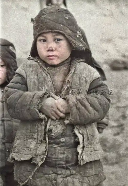 图为河南大饥荒中的一个已经浮肿的儿童.