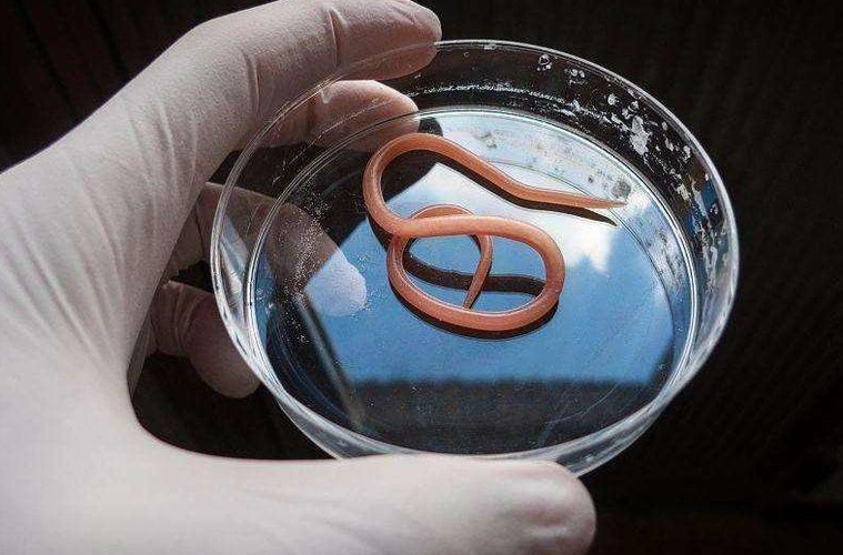 肚子里有蛔虫怎么办 先别慌 这些治疗方法千万牢记!