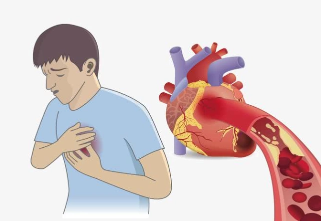 安贞医院汇总10年数据发现:年轻"心梗"患者里,95%是男性
