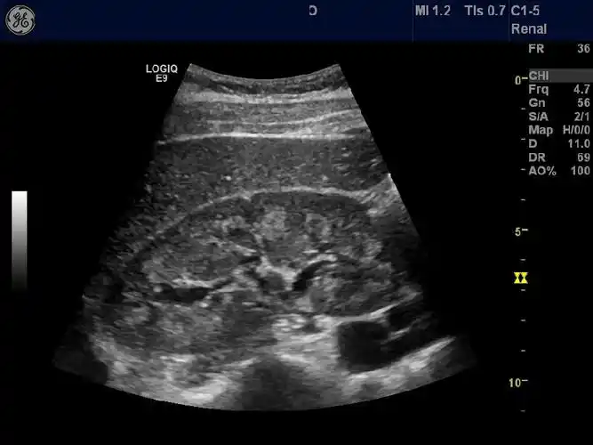 泌尿系统 肾脏图像