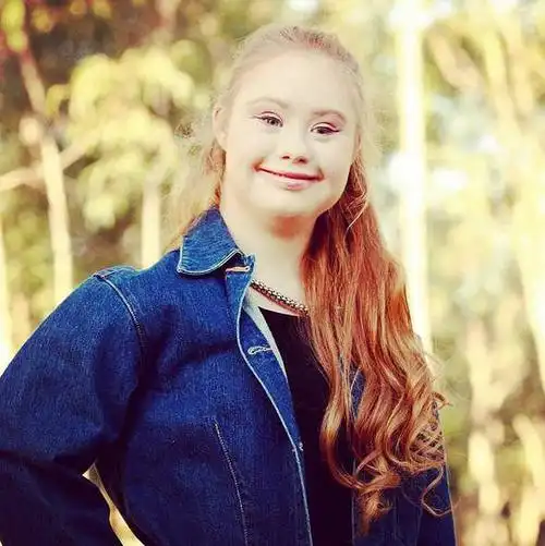 爱笑的人运气都不会差 | 唐氏综合征女孩因为爱笑受邀赴纽约时