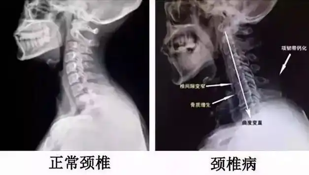 小巧便携的u型枕,对颈椎好,对睡眠更好|收纳|枕头|亲肤|u型枕_网易