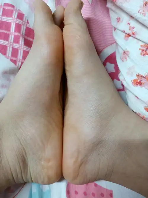 请问大家我是扁平足吗?