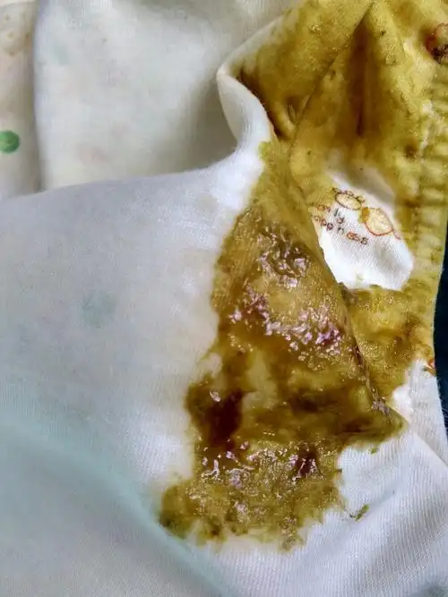 便便里面有褐褐色的东西 是不是血?怎么回事 要不要看医生?