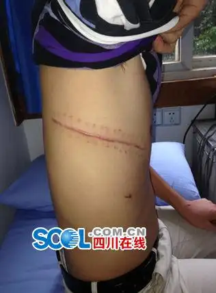 记者回访资阳南津镇被砍两警察伤势恢复一人调离组图