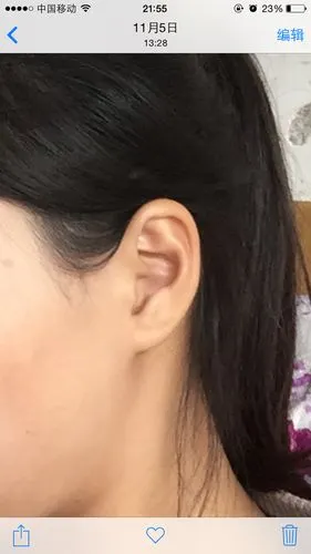 小女子对面相很感兴趣,耳朵中有属于金,木,剑羽,棋子等等多种耳型,求