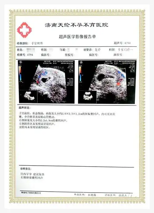 习惯性流产,保胎治疗,胎儿稳定发育中