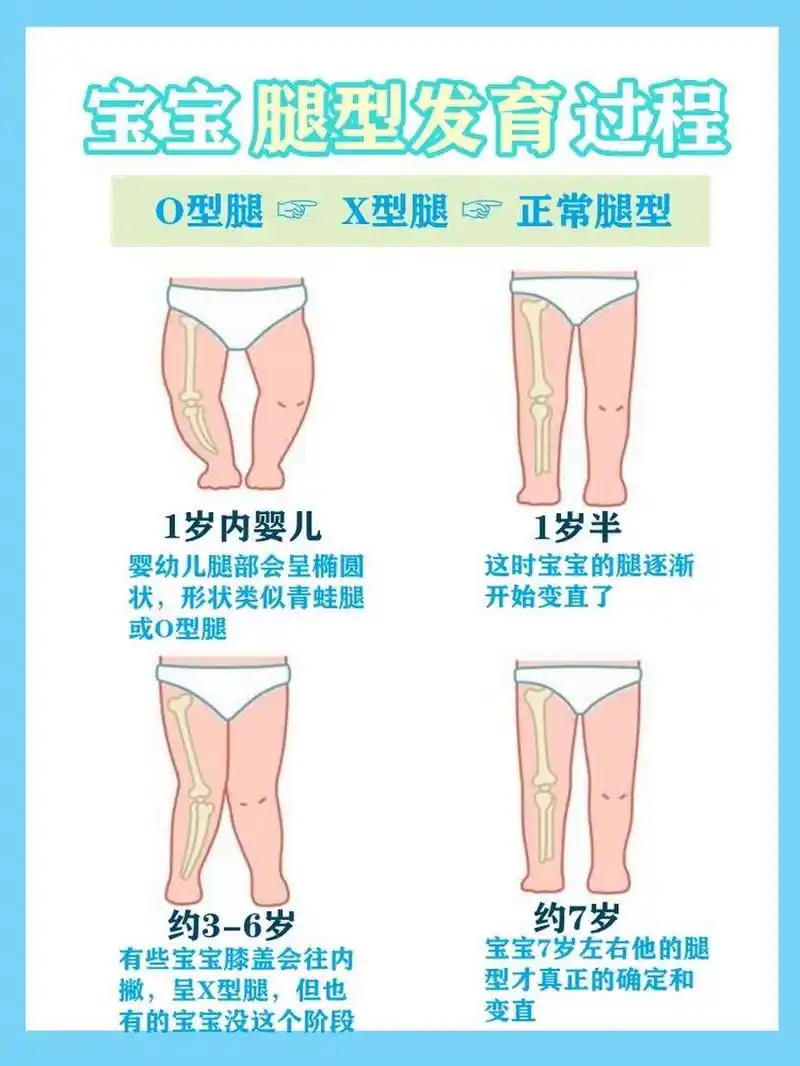 8215新生儿-1岁半: o型腿 82151岁半-2岁:正常腿型 8215
