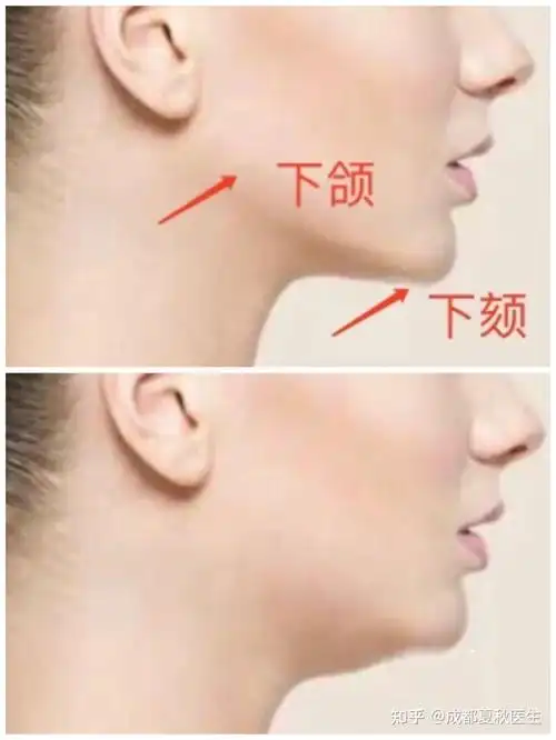 下颌线不清晰都是胖出来的