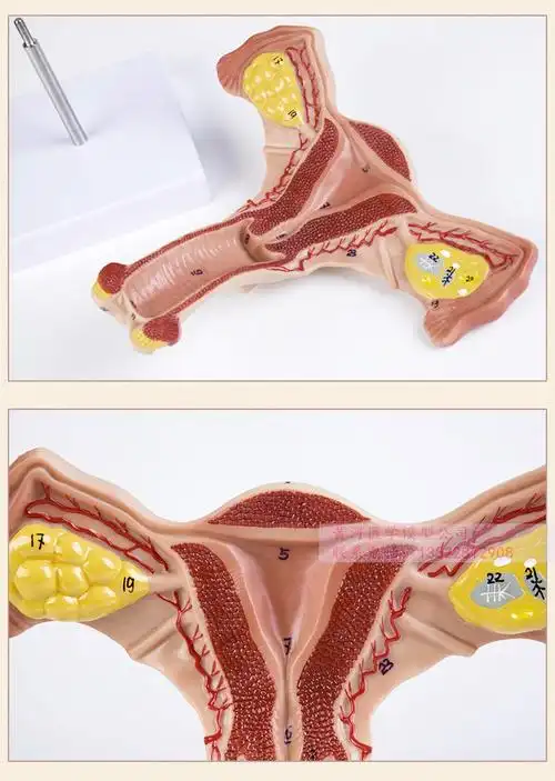 子宫模型卵巢女性内外生殖器官模型生殖科妇科医用演示病理子宫