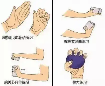 风湿病|腕关节|晨僵|握拳|淋巴|-健康界