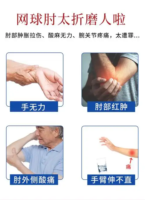 日本网球肘专用贴胳膊肘关节肿胀肘外侧疼痛抬臂困难冷敷凝胶一盒装