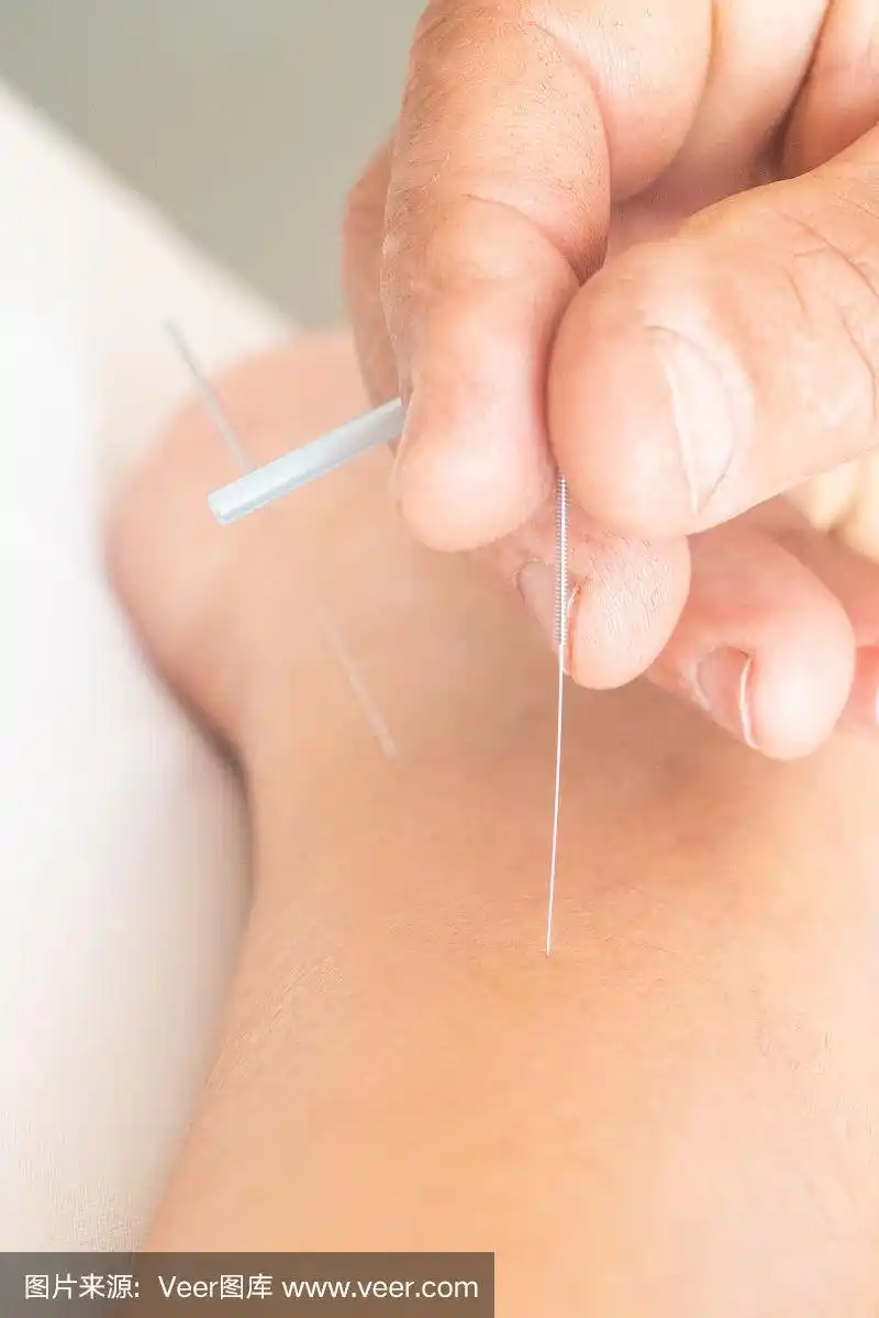 在腿和脚上针灸