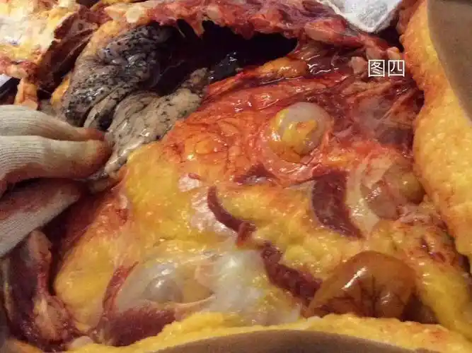 解剖尸体后终于找到死亡原因了