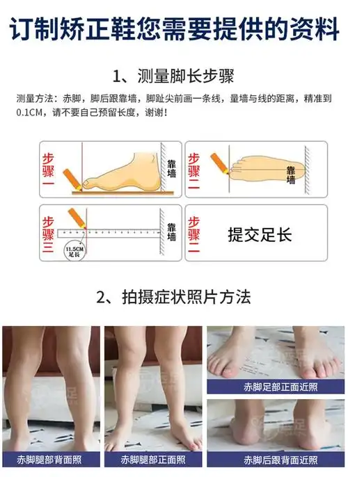 矫正鞋小孩足外翻后跟变形外八字扁平足脚马蹄足内翻踮脚纠正长短xo腿